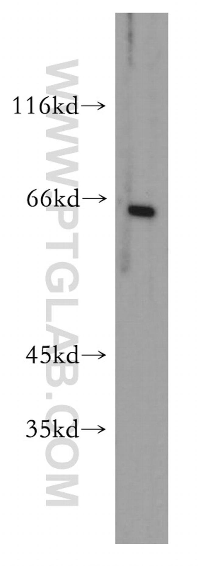 FOXG1 Antibody in Western Blot (WB)