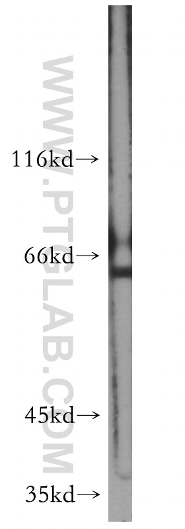 FOXG1 Antibody in Western Blot (WB)