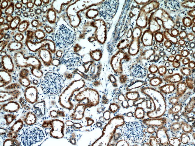 BBS4 Antibody in Immunohistochemistry (Paraffin) (IHC (P))