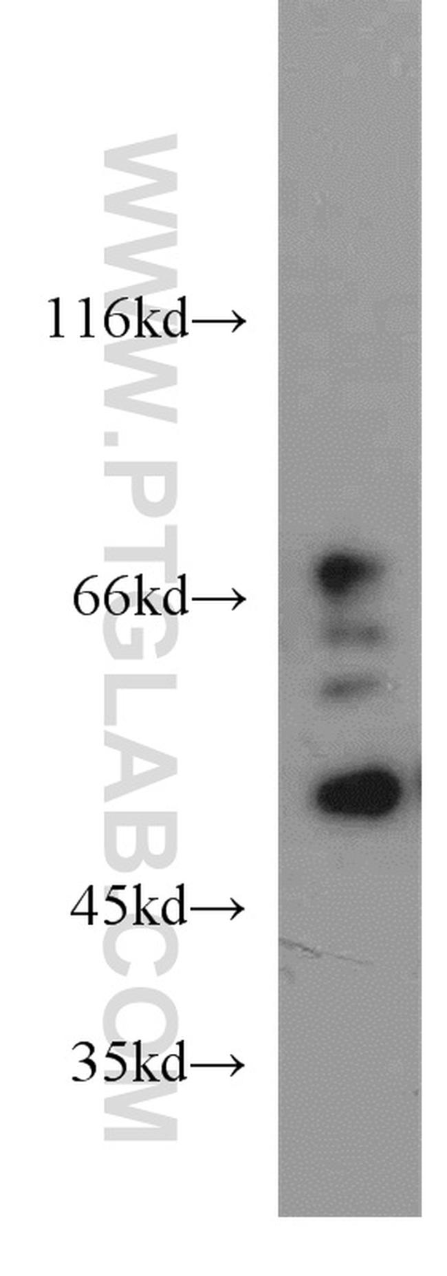 BBS4 Antibody in Western Blot (WB)