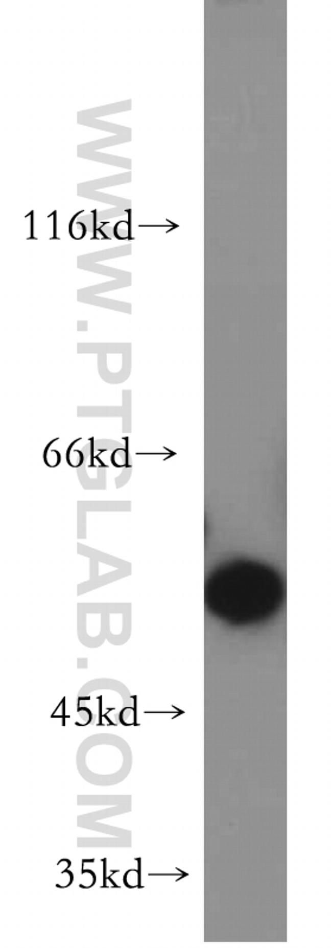 BBS4 Antibody in Western Blot (WB)