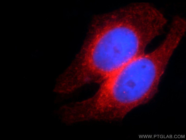 IFITM2 Antibody in Immunocytochemistry (ICC/IF)