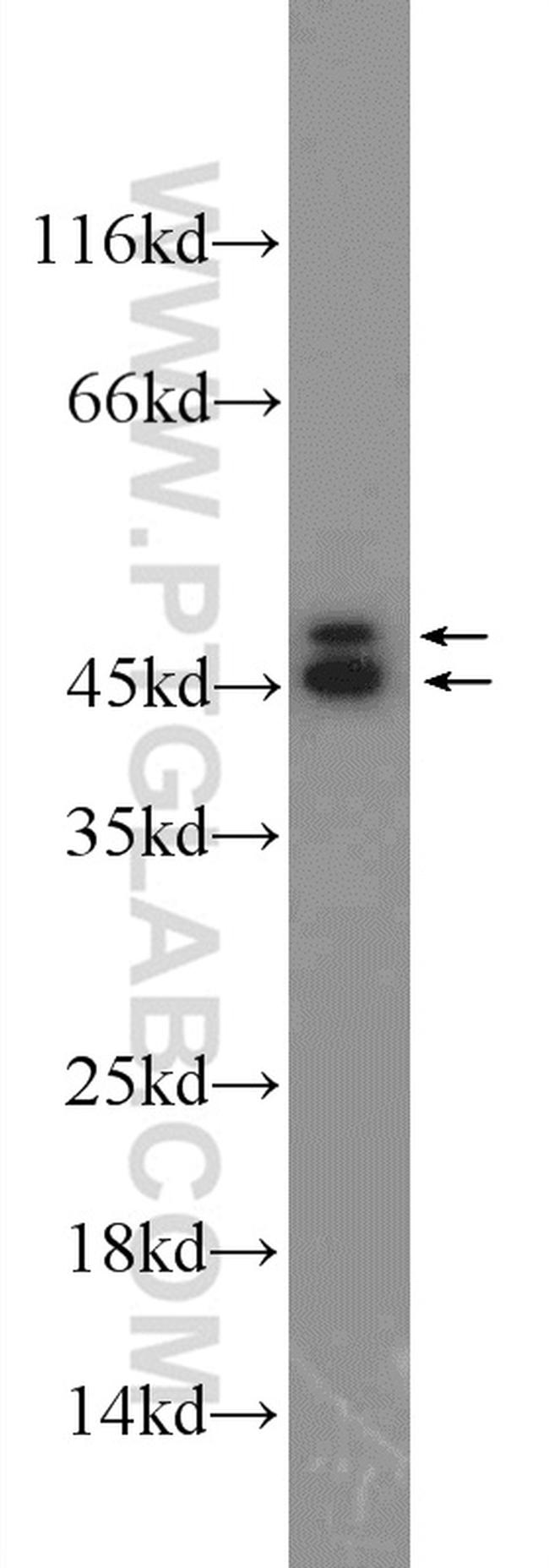 HNRNPD Antibody in Western Blot (WB)