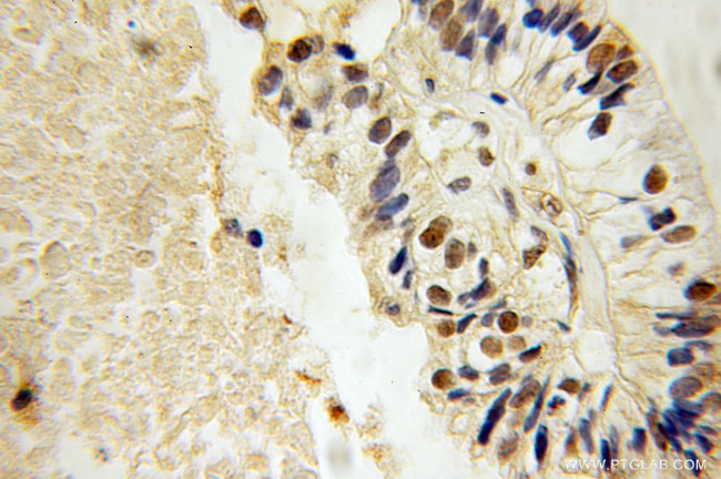 MAFF Antibody in Immunohistochemistry (Paraffin) (IHC (P))