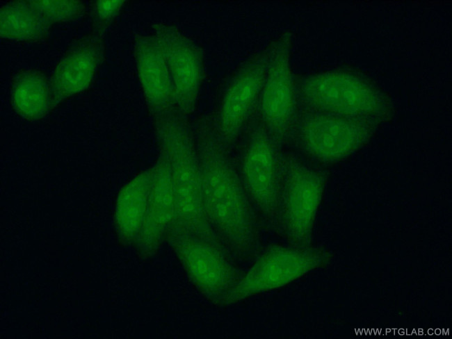 KRR1 Antibody in Immunocytochemistry (ICC/IF)