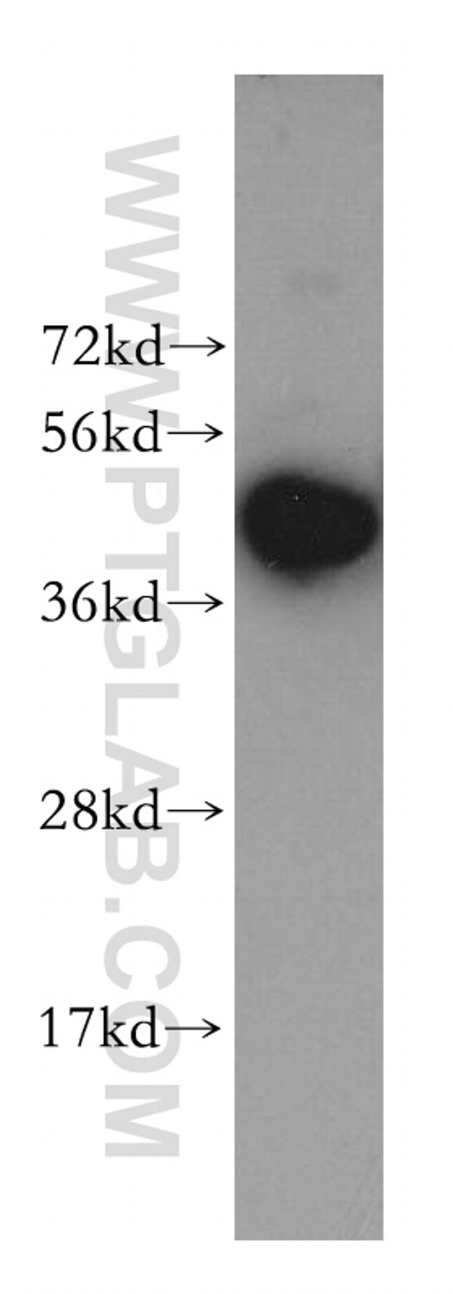 KRR1 Antibody in Western Blot (WB)