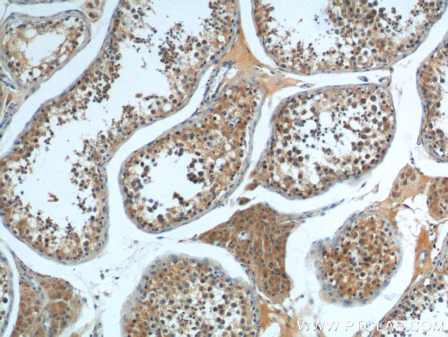 CP110 Antibody in Immunohistochemistry (Paraffin) (IHC (P))