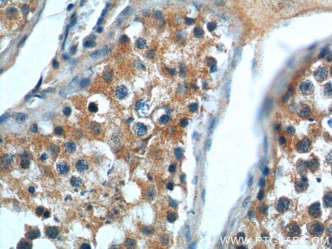 CP110 Antibody in Immunohistochemistry (Paraffin) (IHC (P))