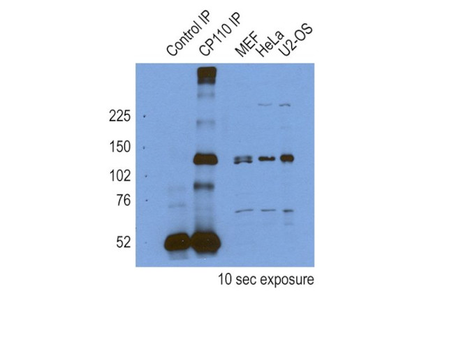 CP110 Antibody in Immunoprecipitation (IP)