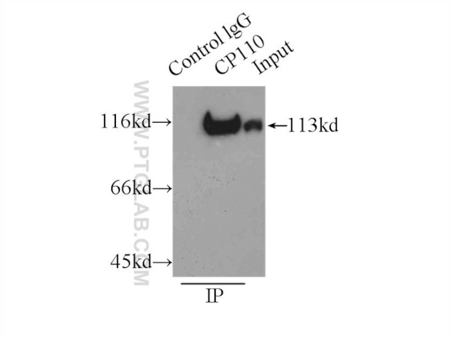 CP110 Antibody in Immunoprecipitation (IP)