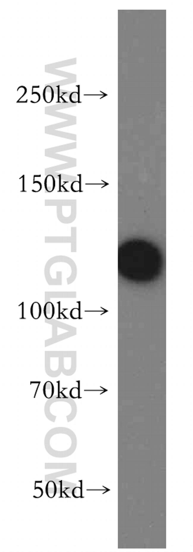 CP110 Antibody in Western Blot (WB)