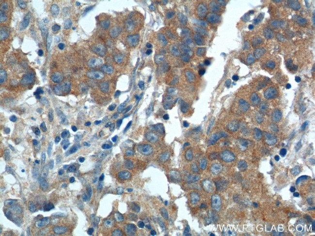 CP110 Antibody in Immunohistochemistry (Paraffin) (IHC (P))