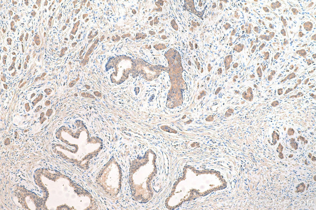 CP110 Antibody in Immunohistochemistry (Paraffin) (IHC (P))