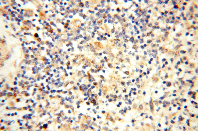 CBLB Antibody in Immunohistochemistry (Paraffin) (IHC (P))