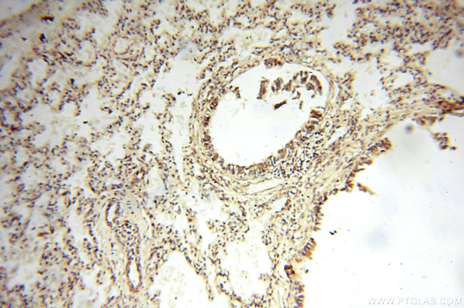 CBLB Antibody in Immunohistochemistry (Paraffin) (IHC (P))