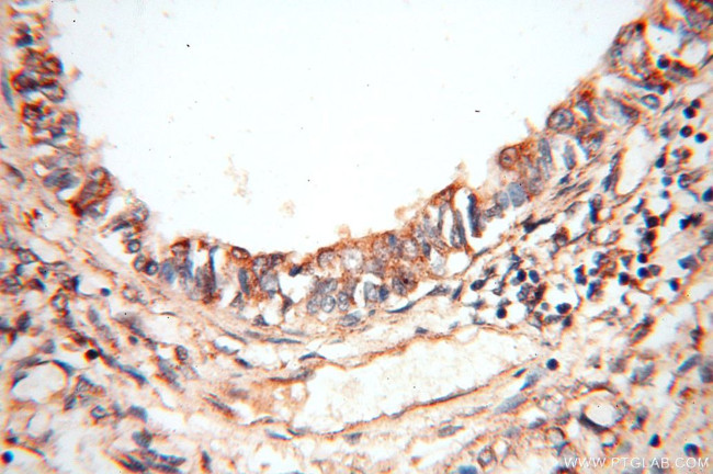 CBLB Antibody in Immunohistochemistry (Paraffin) (IHC (P))