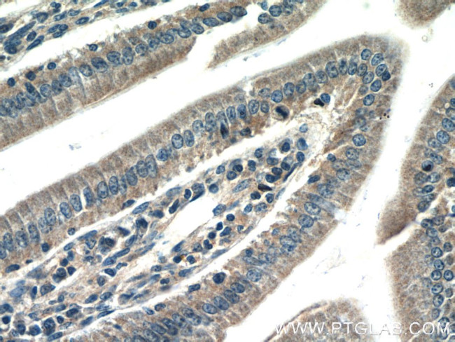 CBLB Antibody in Immunohistochemistry (Paraffin) (IHC (P))