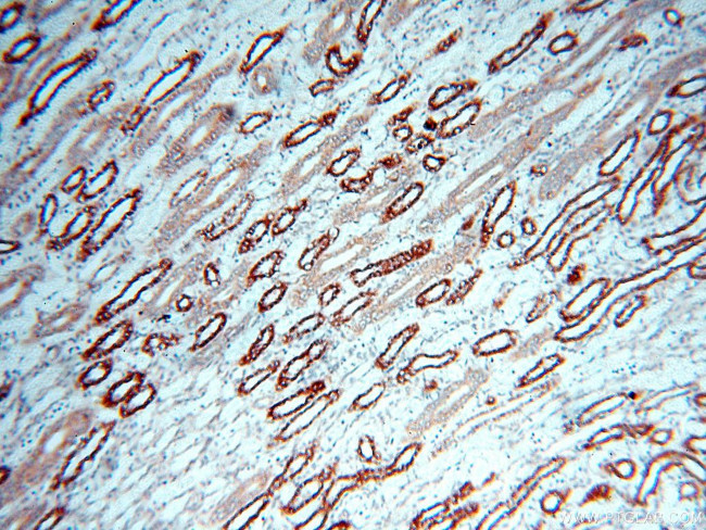 CBLB Antibody in Immunohistochemistry (Paraffin) (IHC (P))