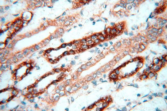 CBLB Antibody in Immunohistochemistry (Paraffin) (IHC (P))