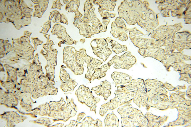 CBLB Antibody in Immunohistochemistry (Paraffin) (IHC (P))