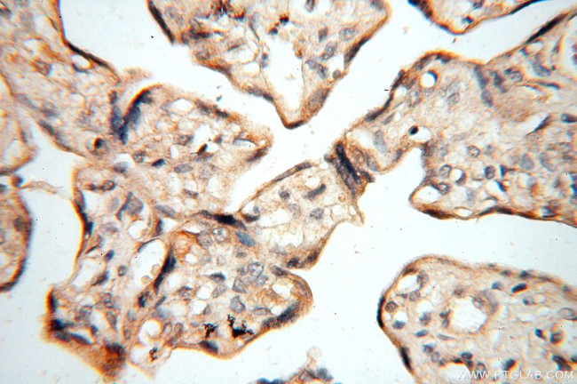 CBLB Antibody in Immunohistochemistry (Paraffin) (IHC (P))