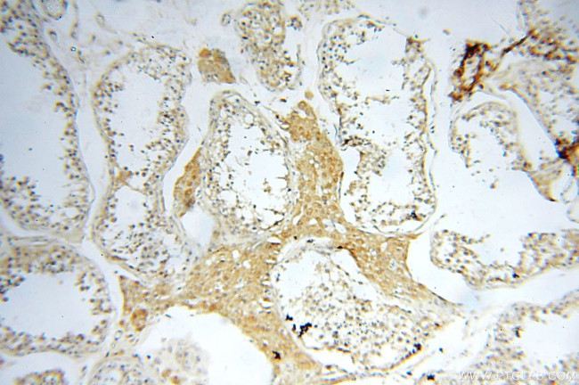 CBLB Antibody in Immunohistochemistry (Paraffin) (IHC (P))