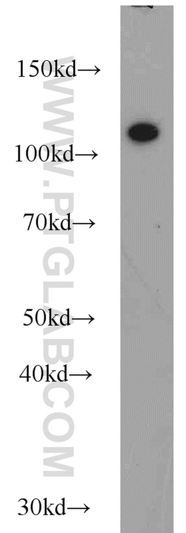 CBLB Antibody in Western Blot (WB)