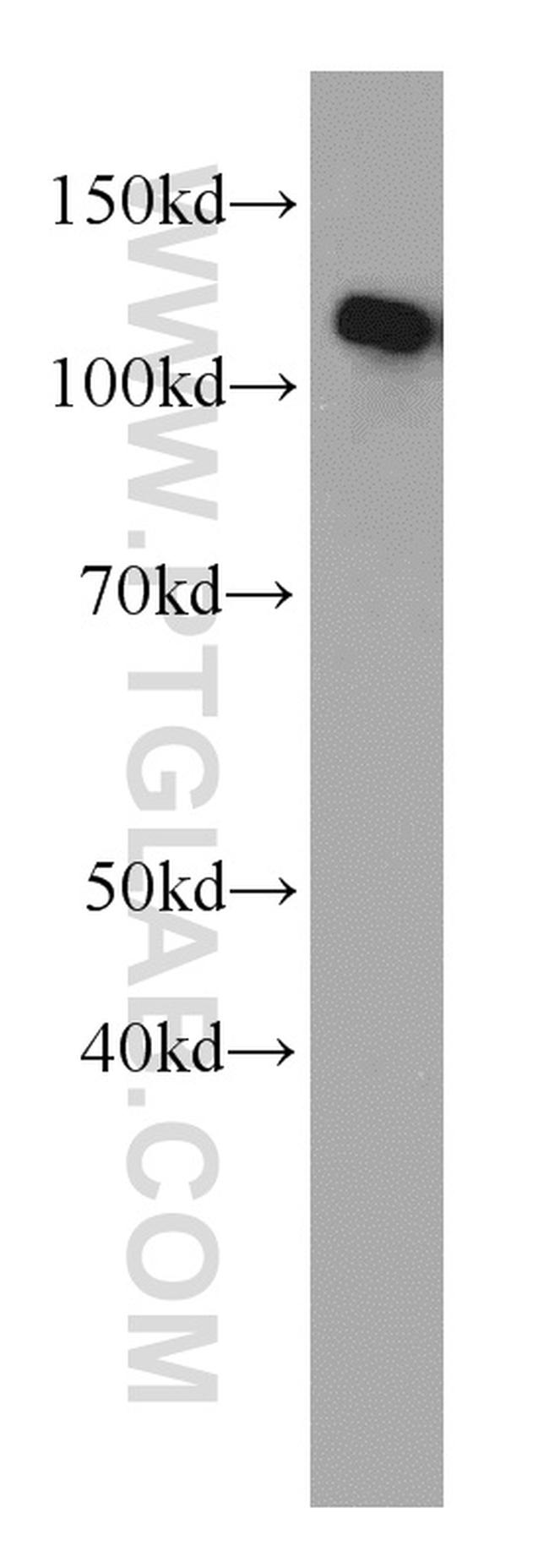 CBLB Antibody in Western Blot (WB)