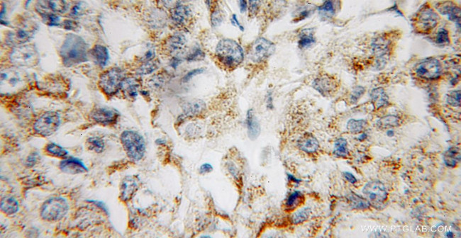 CBLB Antibody in Immunohistochemistry (Paraffin) (IHC (P))