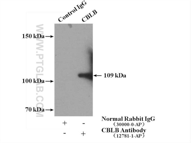 CBLB Antibody in Immunoprecipitation (IP)