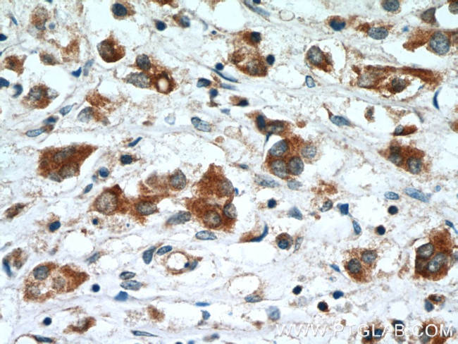 BCL2 Antibody in Immunohistochemistry (Paraffin) (IHC (P))