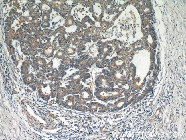 BCL2 Antibody in Immunohistochemistry (Paraffin) (IHC (P))