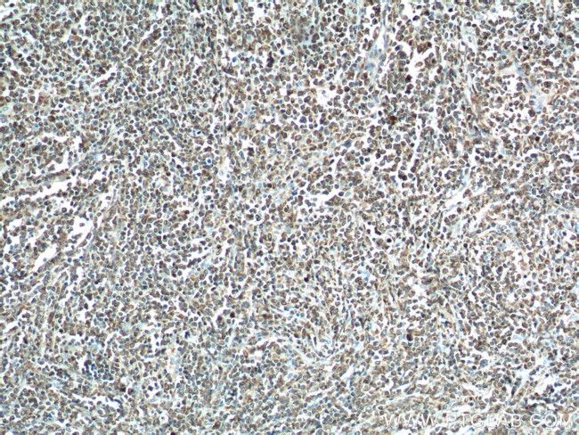 BCL2 Antibody in Immunohistochemistry (Paraffin) (IHC (P))