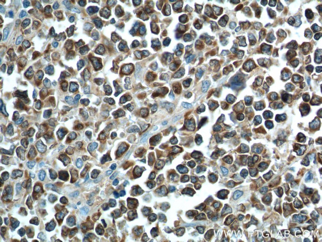 BCL2 Antibody in Immunohistochemistry (Paraffin) (IHC (P))