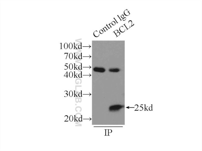 BCL2 Antibody in Immunoprecipitation (IP)