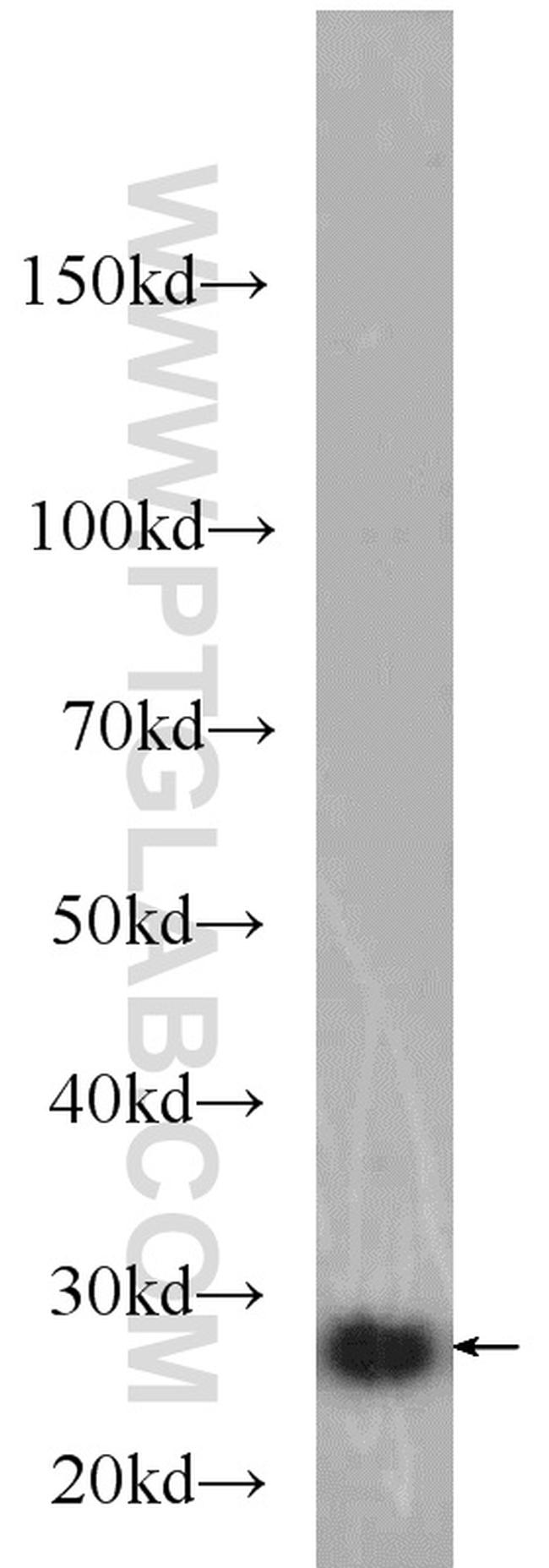 BCL2 Antibody in Western Blot (WB)