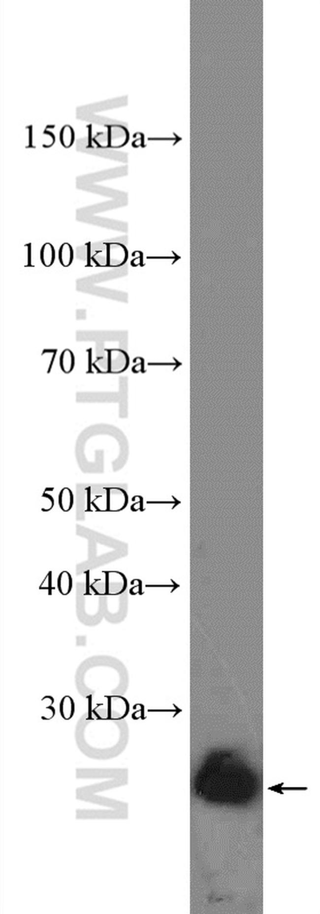 BCL2 Antibody in Western Blot (WB)