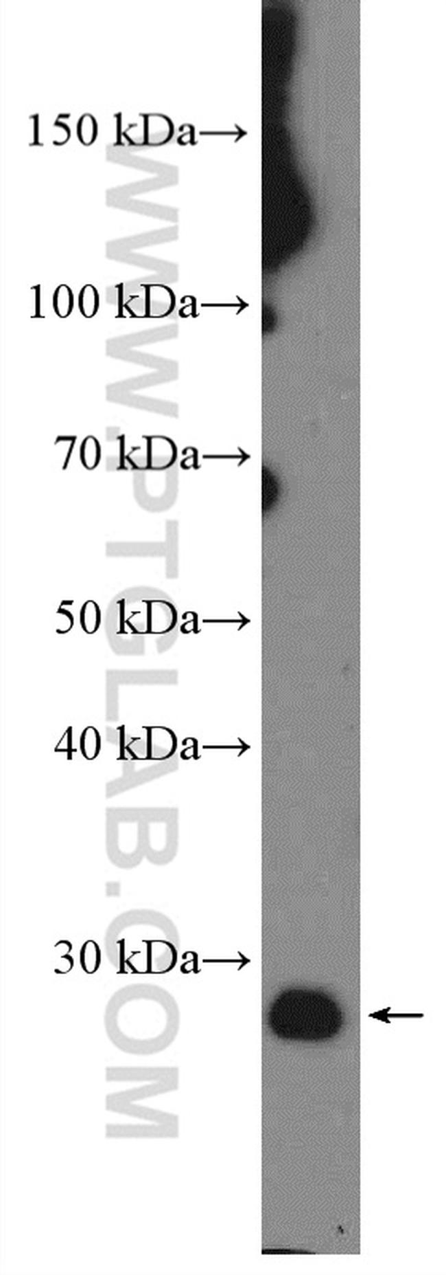 BCL2 Antibody in Western Blot (WB)