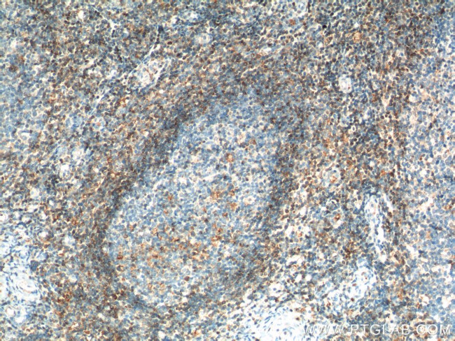 BCL2 Antibody in Immunohistochemistry (Paraffin) (IHC (P))