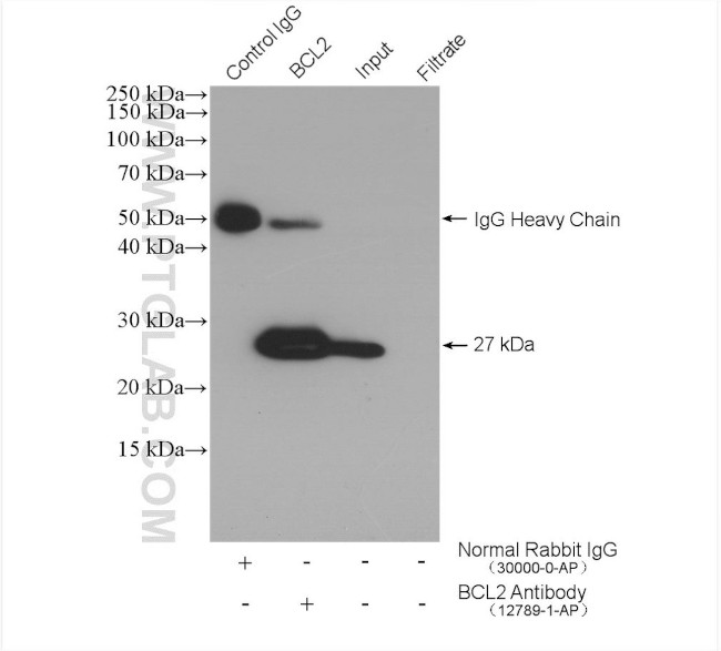 BCL2 Antibody in Immunoprecipitation (IP)