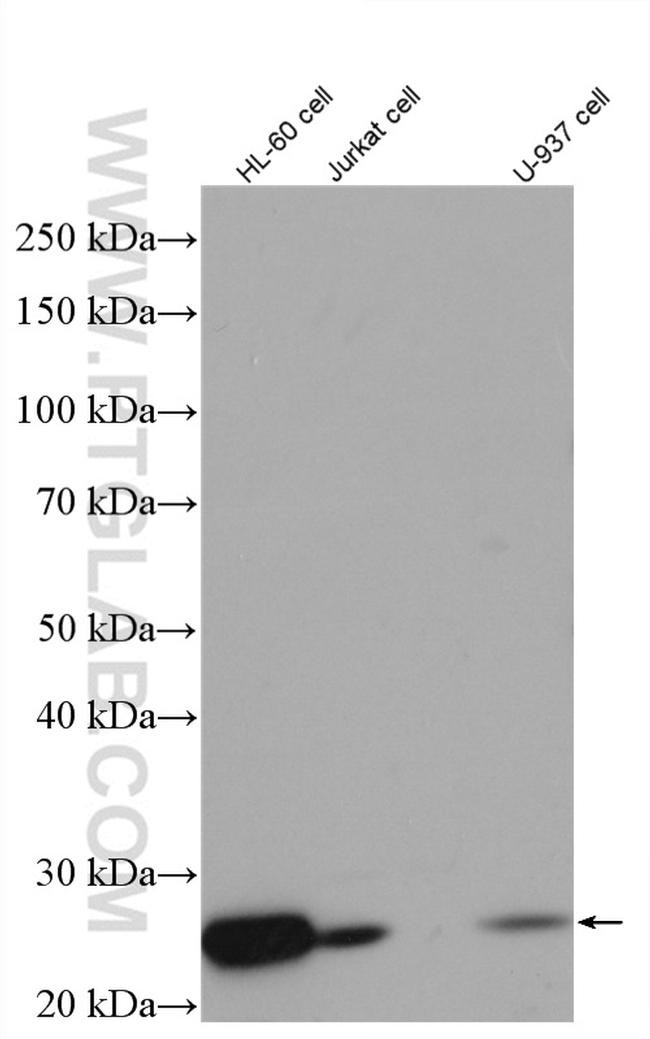 BCL2 Antibody in Western Blot (WB)