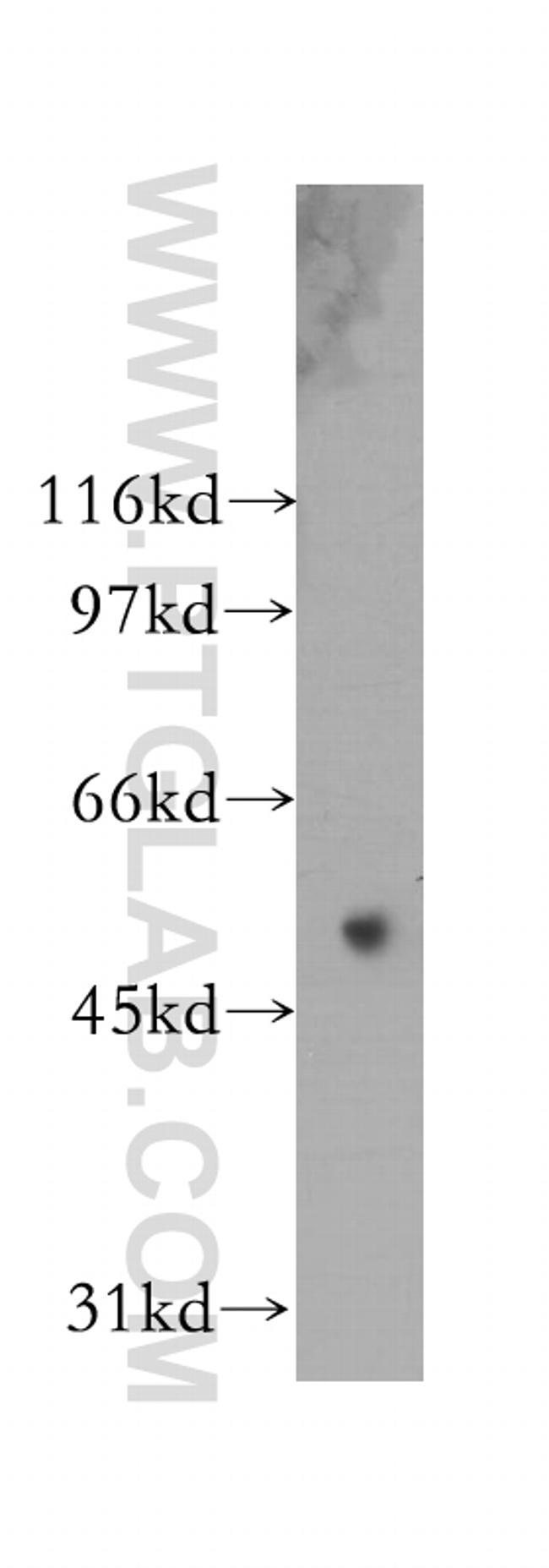 Synaptotagmin-9 Antibody in Western Blot (WB)