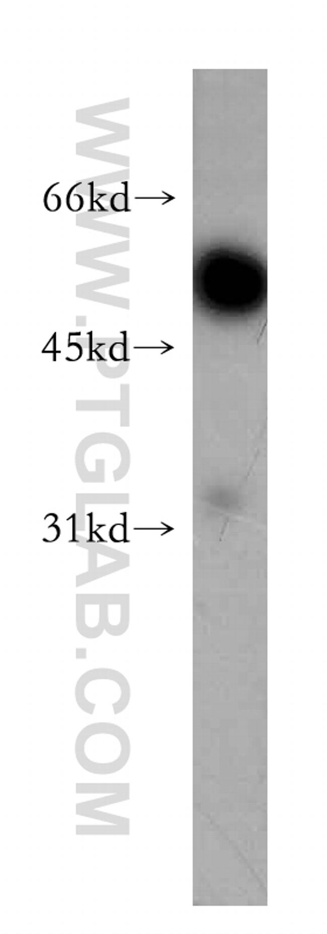 Synaptotagmin-9 Antibody in Western Blot (WB)