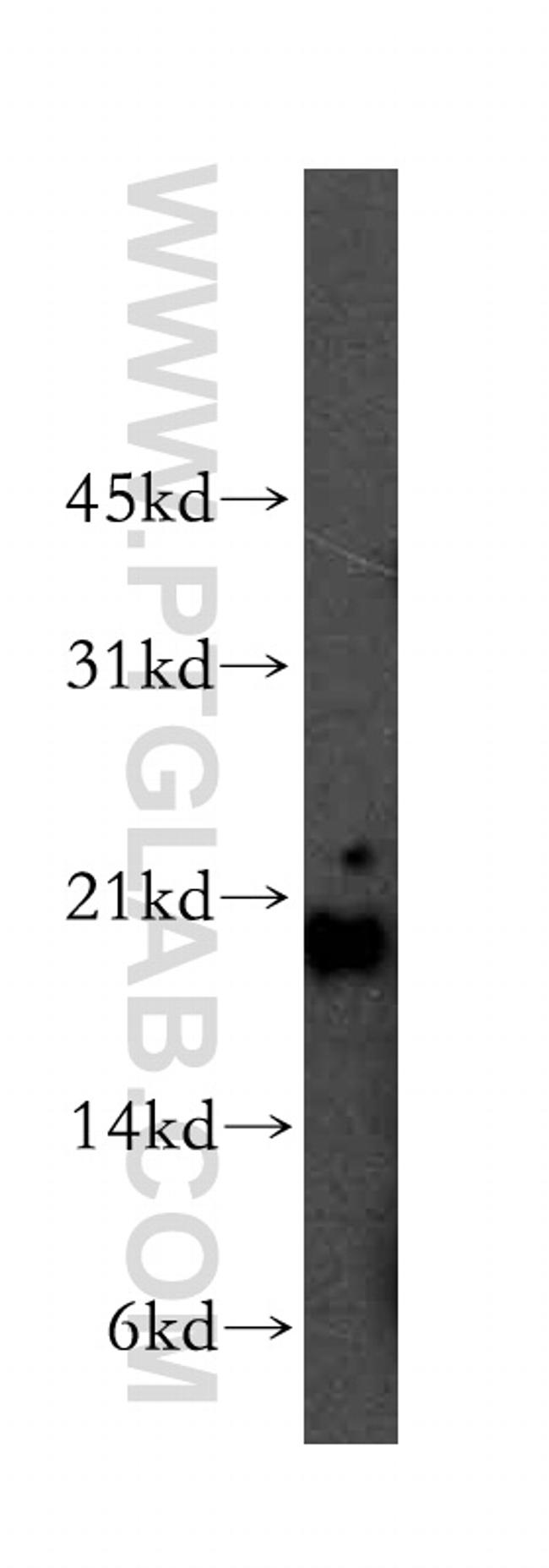 Centrin 1 Antibody in Western Blot (WB)