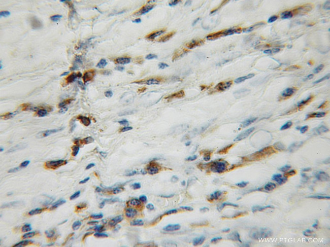 GAGE1 Antibody in Immunohistochemistry (Paraffin) (IHC (P))