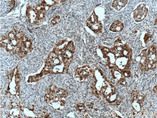 HSPA2 Antibody in Immunohistochemistry (Paraffin) (IHC (P))