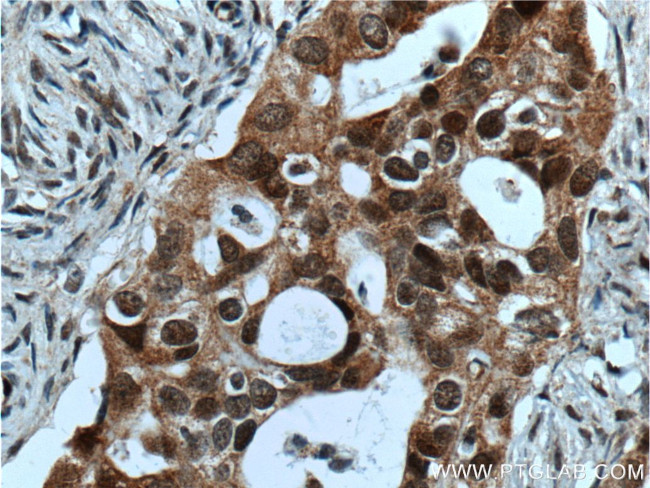 HSPA2 Antibody in Immunohistochemistry (Paraffin) (IHC (P))