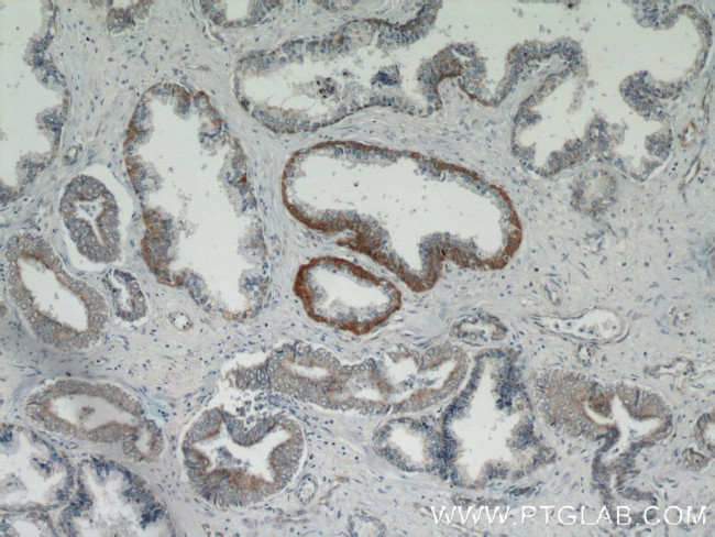 HSPA2 Antibody in Immunohistochemistry (Paraffin) (IHC (P))