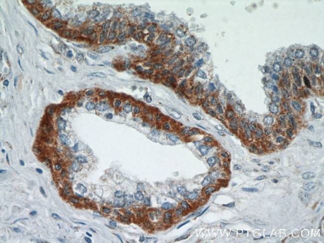 HSPA2 Antibody in Immunohistochemistry (Paraffin) (IHC (P))