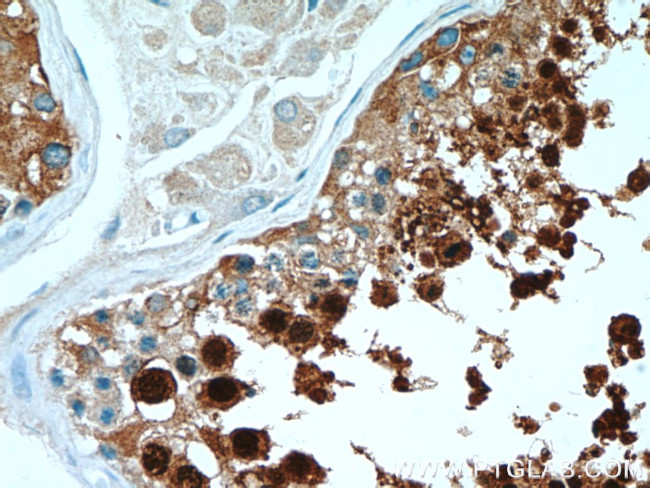 HSPA2 Antibody in Immunohistochemistry (Paraffin) (IHC (P))